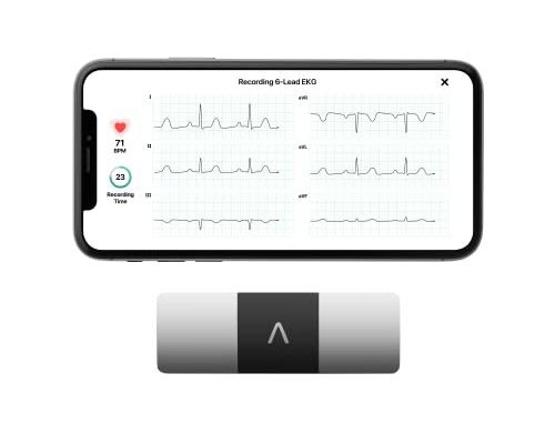 KardiaMobile 6-Lead Personal EKG Monitor – Six Views of The Heart – Detects AFib and Irregular Arrhythmias – Instant Results in 30 seconds – Works with Most Smartphones - FSA/HSA Eligible